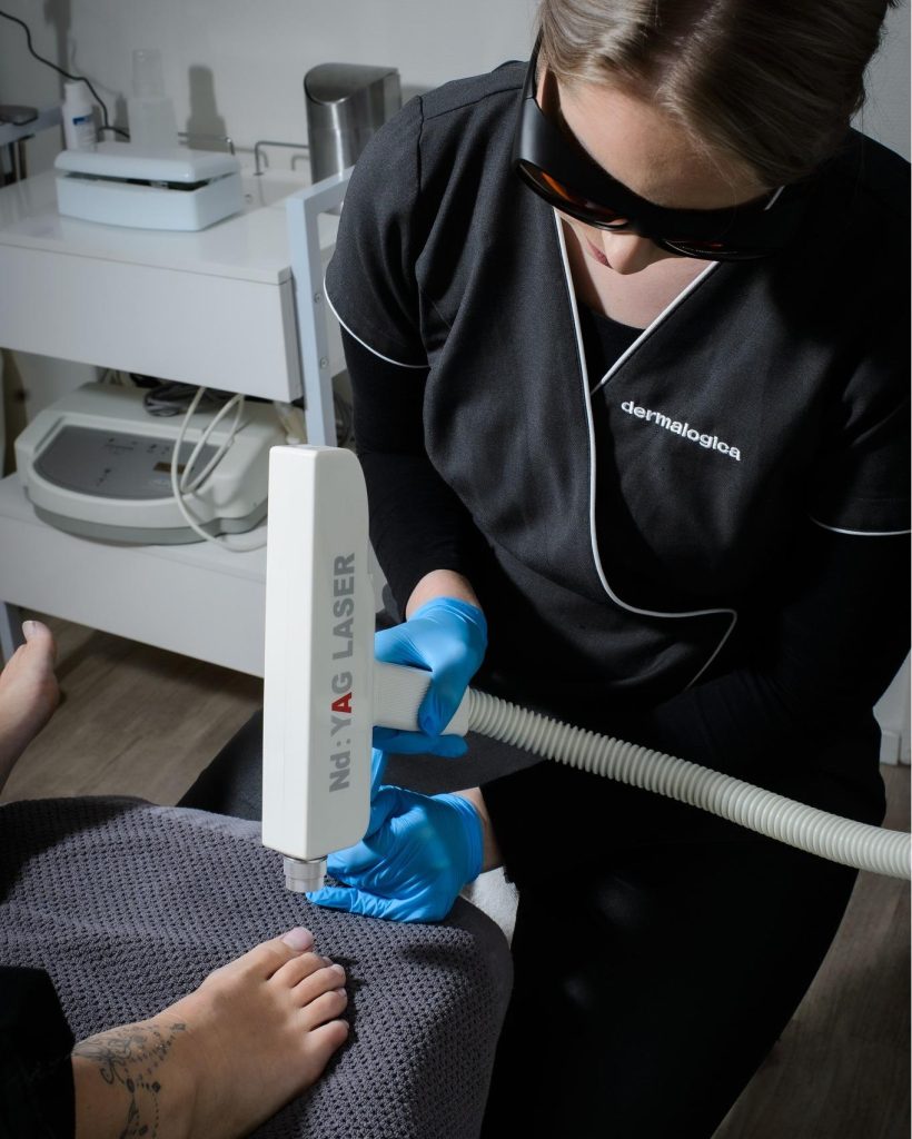 Professionele acne behandeling in Gorinchem bij Huidinstituut Callista voor gezonde huid